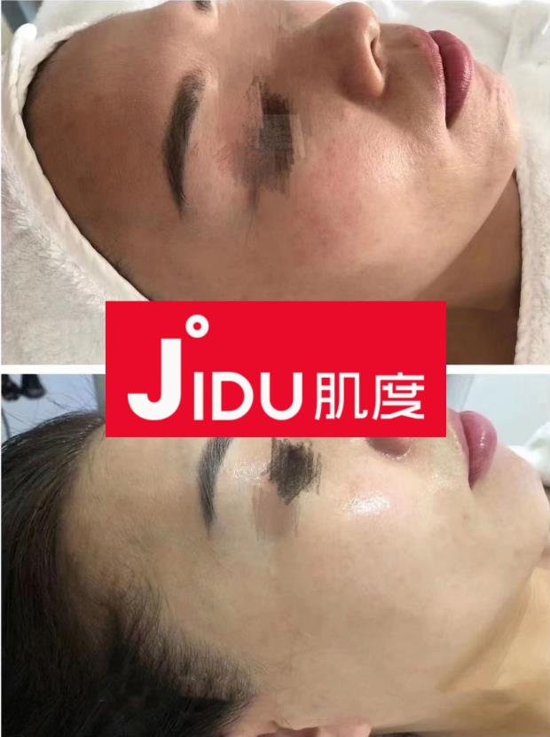 肌度:美容院銷售額從1000到10萬+,銷售大神教你賣貨