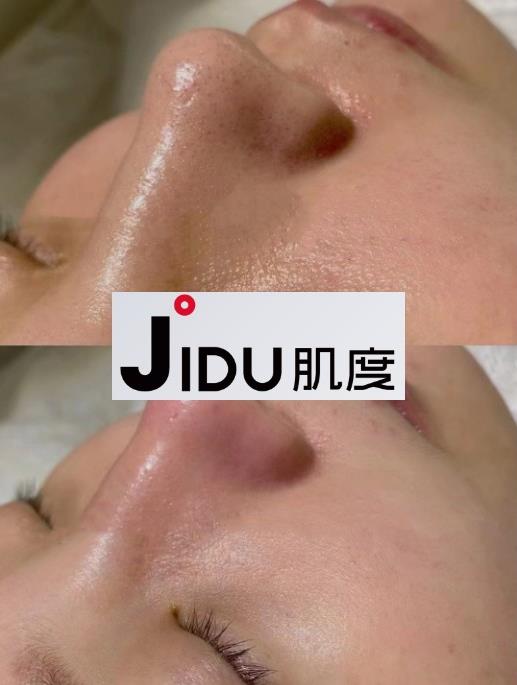 肌度:美容院銷售額從1000到10萬+,銷售大神教你賣貨