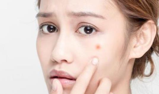 長痘痘的人需要注意什么?長痘痘的人日常護理