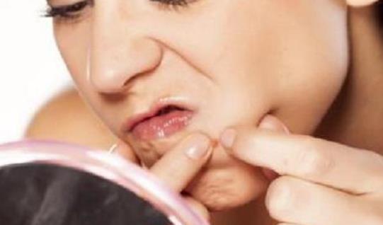 長痘痘的人需要注意什么?長痘痘的人日常護理