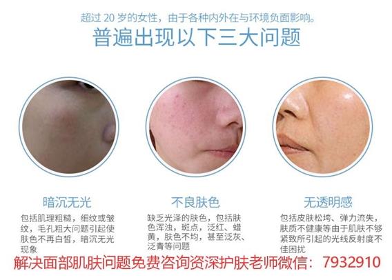 祛痘護(hù)膚有什么比較好的產(chǎn)品推薦?朵嘉濃祛痘凝膠