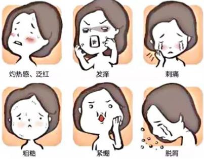 激素臉有哪些癥狀表現?解答激素臉反復總不好怎么辦