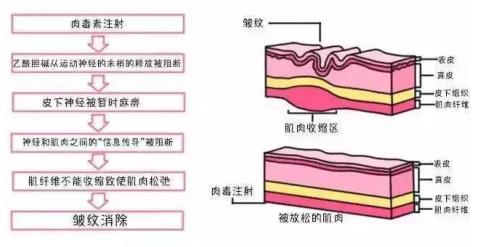北京伊美爾健翔醫院:果酸煥膚有危險嗎