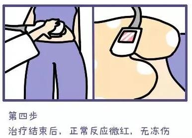 武漢藝星整形醫(yī)院:6月22-28日酷塑減脂專場,讓你輕輕松松的減肥!