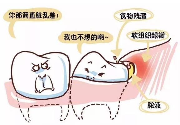 發(fā)炎疼痛的智齒為什么不能立刻拔掉?智齒一定要拔嗎?