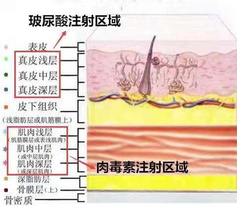 怕痛怕動刀?王的整形楊汝教你午休一刻搞定微整形