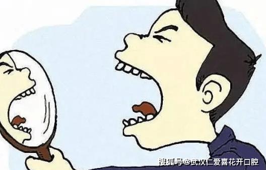 武漢仁愛口腔一位63歲蘇先生被確診為“頰粘膜高分化鱗癌”,罪魁禍?zhǔn)资沁z留多年“殘根”