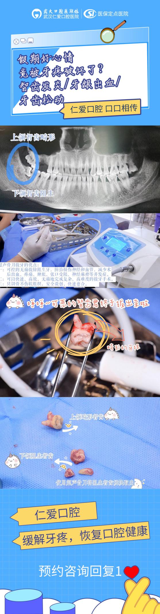 國慶假期去哪玩?不如來武漢仁愛口腔免費(fèi)看牙 還有驚喜福利等你拿