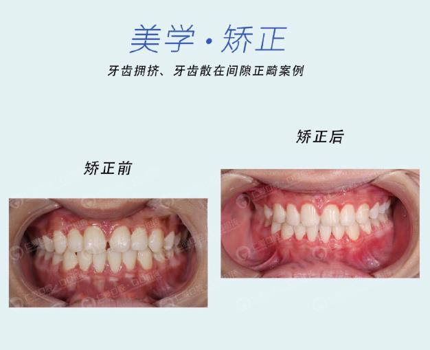 武漢仁愛口腔牙齒矯正技術好不好?