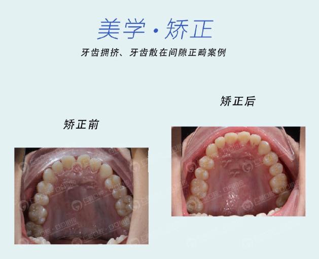 武漢仁愛口腔牙齒矯正技術好不好?