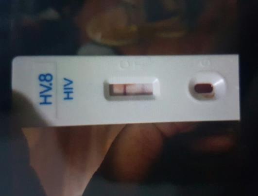 hiv試紙藥店能買到嗎?hiv試紙過期了測出的結果還準不準