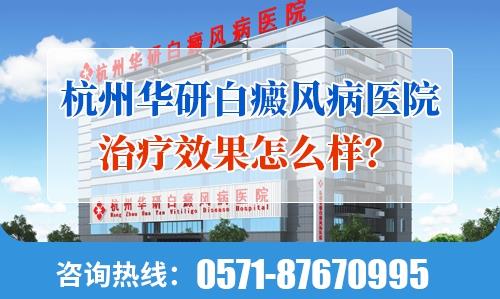 杭州華研白癜風病醫院治療效果怎么樣?