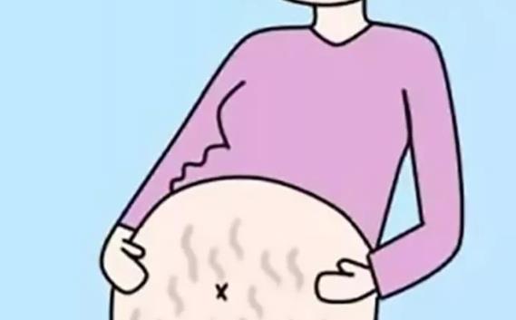 女性對于消除妊娠紋存在一定的誤解 消除妊娠紋常遇到的四大誤區
