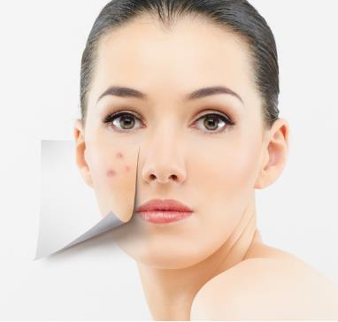臉上長痘痘是什么原因?臉上長痘痘怎么調理?青春痘怎么消除