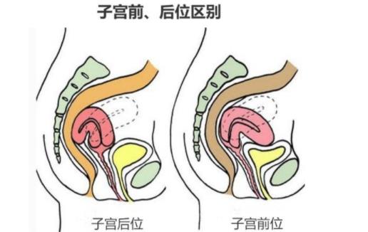 子宮前位容易懷孕嗎 子宮前位和子宮后位的區別