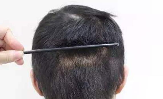 誰都不想提前衰老 男人提前衰老預(yù)防的方法介紹給你