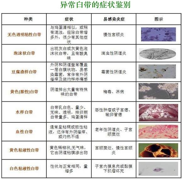 正常白帶是什么樣子的真實(shí)圖片 白帶異常各種癥狀圖片大全