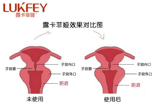 私護(hù)產(chǎn)品什么品牌好,首選國家最安全的私護(hù)產(chǎn)品