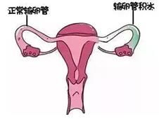 重慶送子鳥關懷健康行,孕路援助暖心間