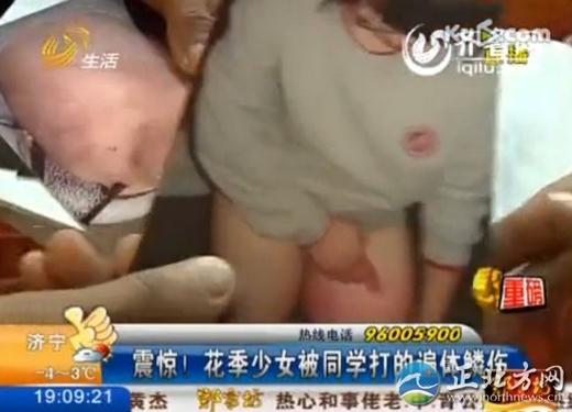 16歲花季少女被四名室友毆打4小時(shí)，脫光了跪在地上打，打得遍體鱗傷