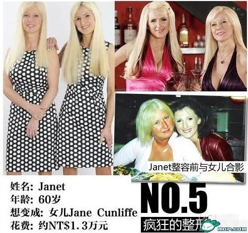 坑爹時代：那些奇葩的瘋狂變臉整容，坑爹呀