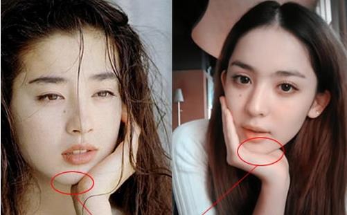          <p>如今，整形美容在學生群體當中開始普及起來了。為了進大學后能給同學和老師留下最美的第一印象，很多高中生紛紛去整形，以下就是90后青睞的整形項目。</p> <p>　<strong>　TOP1：眼睛要像濱崎步一樣大</strong></p> <p><strong>整形組合：重瞼術+開內外眼角</strong></p> <p>90后是最有個性的孩子，盡管她們喜歡單眼皮男生，但對于應該屬于女生的大眼睛仍然十分向往，所以割雙眼皮一向是她們最愛的小手術。由于近年來大小青春偶像明星時有傳出開內外眼角的消息，也促使她們對這一非主流的小小整形術多了一份關注。而且像日本明星濱崎步那樣明亮有神的大眼睛漸漸也成為她們的整形目標。因此，重瞼術+開內外眼角是她們最喜愛的整形組合。</p> <p>　<strong>　TOP2：臉要瘦點再瘦點</strong></p> <p><strong>整形組合：瘦臉針+墊下巴</strong></p> <p>90后的孩子受教育的程度較高，所以中國傳統審美觀念對她們的影響也比較大。她們與中國古典美人一樣喜歡面部線條柔和的鵝蛋臉，而且下巴一定要夠挺俏。因《大長今》紅遍亞洲的李英愛是東方美麗與氣質兼具的典型，她具有女性柔美標志的下巴，那略尖與略朝上的俏模樣，是流露嬌俏女性特質的最佳表現。因此，瘦臉+墊下巴成為90后的美麗新追求。</p> <p>　<strong>　TOP3：俏臉光滑細致</strong></p> <p><strong>整形組合：像束激光+復合彩光嫩膚</strong></p> <p>哈韓、哈日的90后MM受韓劇、日劇明星的完美出鏡與韓劇唯美主義的影響，絕對不會允許臉上不干不凈，臉龐平滑細致的肌膚是最能體現她們內心對完美的追求。像束激光是近年推出的一項激光美容新技術，主要解決粗大毛孔、痤瘡疤痕、細小皺紋、粗糙、斑斑點點等皮膚問題。復合彩光嫩膚采用專利的強脈沖光技術，選擇性作用于皮膚的色素及異常血管等靶組織，徹底祛除皮膚各種瑕疵，恢復皮膚細膩、凈白，因此，像束激光和復合彩光嫩膚也漸漸成為她們的整形新寵。</p>