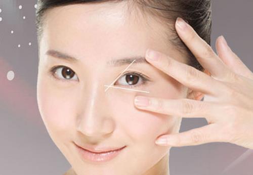 內(nèi)眼角開大手術(shù)適合所有的女性嗎