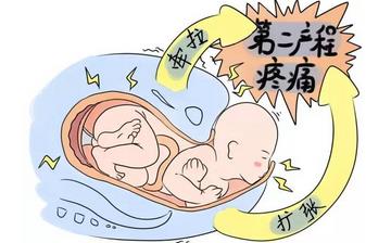 【順產】順產與剖腹產的區別_順產疼嗎_哪些人不適合順產_無痛自然分娩是什么