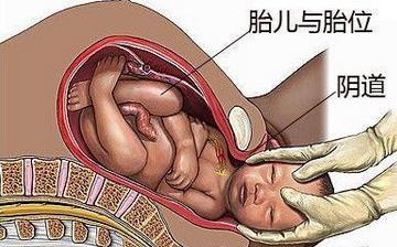 【分娩】分娩注意什么_分娩前的征兆_分娩視頻全過(guò)程_分娩后吃什么補(bǔ)身體 【分娩】分娩注意什么_分娩前的征兆_分娩視頻全過(guò)程_分娩后吃什么補(bǔ)身體