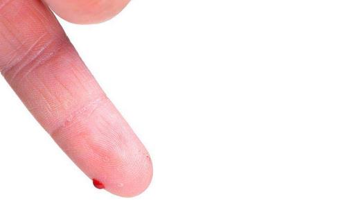 身體出現(xiàn)這些癥狀說明你需要查血糖了！