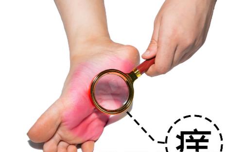 有腳氣的人，經常用鹽水泡腳就能消滅真菌嗎？它沒有這個