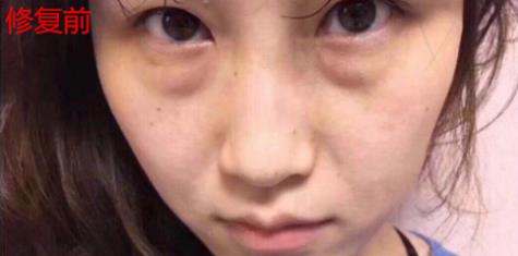 衛(wèi)婭日記：我一直都以為眼袋對(duì)我的影響只是美觀，直到我了解了以后……
