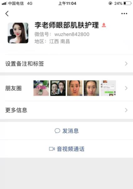 君雅筆記：眼袋過(guò)重，就會(huì)顯得比真實(shí)年齡大，要如何修復(fù)眼袋呢？