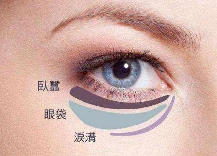八大處整形楊欣幫你講解：眼袋祛除后過幾年還會復(fù)發(fā)嗎？