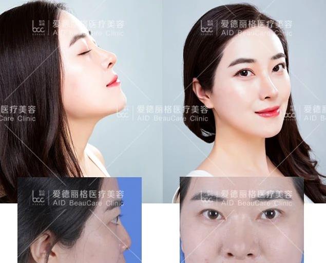 大連愛(ài)德麗格“你好美鼻”免費(fèi)鼻部模特招募活動(dòng)完美落幕